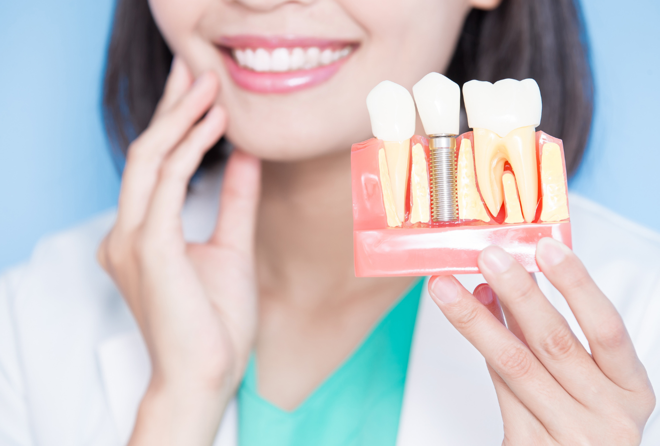 dental_implants_Bradenton_dentist