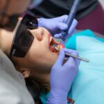 Composite Fillings in Lakewood Ranch