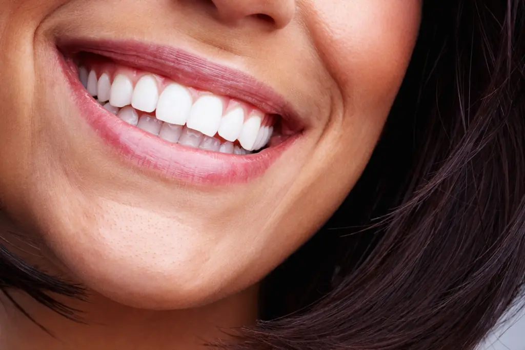 Full Mouth Reconstruction Bradenton, FL