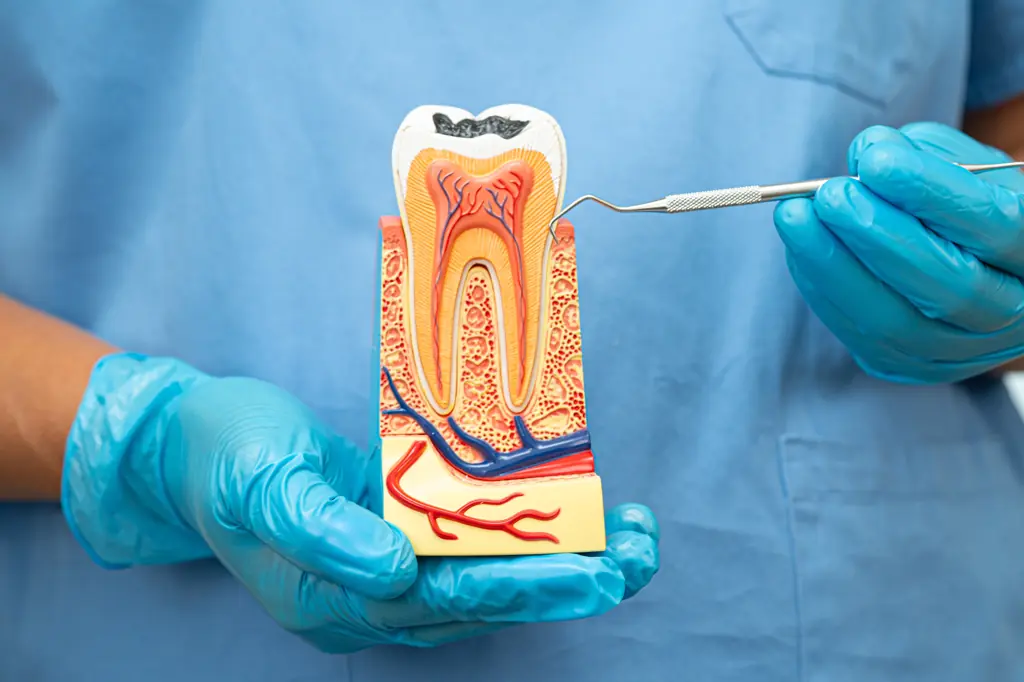 Root Canal Bradenton, FL